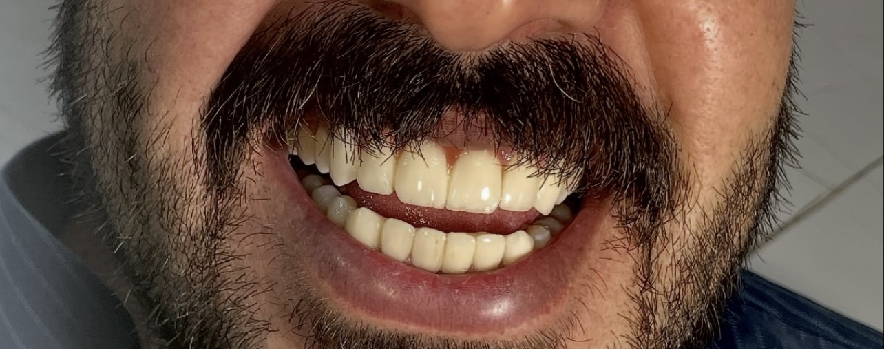 لابراتوار دندانسازی تبسم