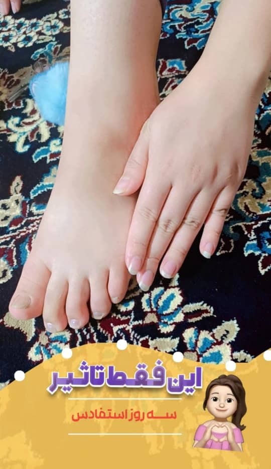کرم معجزه